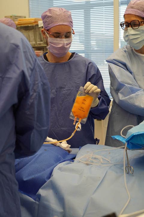 Surgical team handling a graft bag of processed lipoaspirate in the operating room.
